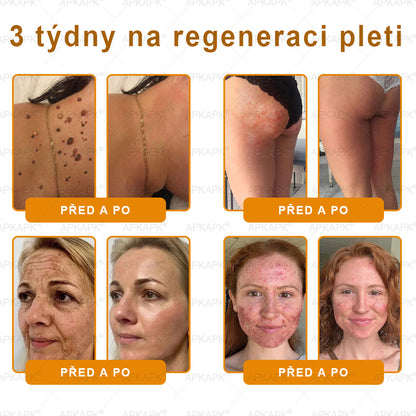 𝖠𝖯𝖪𝖠𝖯𝖪® 🐝 Krém s včelím jedem na obnovu pokožky 🐝 pomáhá při řešení kožních problémů, jako jsou: vrásky, jizvy, pigmentové skvrny, strie, akné, lupénka, ekzém, kožní léze, podráždění, záněty a další kožní potíže.
