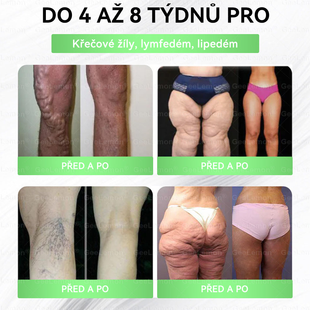 𝐆𝐞𝑒𝑙𝑒𝐦𝐨𝐧®🎁 Posledních 5 balení skladem!🎉Aktivujte si dodatečnou 30% slevu – pouze dnes!  Nepropásněte tuto speciální nabídku, další už nemusí být dostupná.