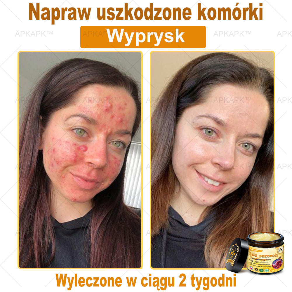 ΑPΚΑPK™ Jad Pszczoły Kompleksowy Krem🥇pomaga w leczeniu problemów skórnych, takich jak: zmarszczki, blizny, plamy pigmentacyjne, rozstępy, trądzik, łuszczyca, egzema, zmiany skórne, podrażnienia, stany zapalne i inne problemy skórne🔥
