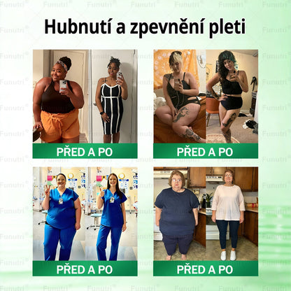 Oficiální obchod 💯 Funutri® 10 v 1 metabolická tvarující náplast s nano mikrojehličkami (Pouze jednou denně, viditelné změny již za 7 dní)  Určeno pro osoby s obezitou, diabetem, spánkovou apnoe