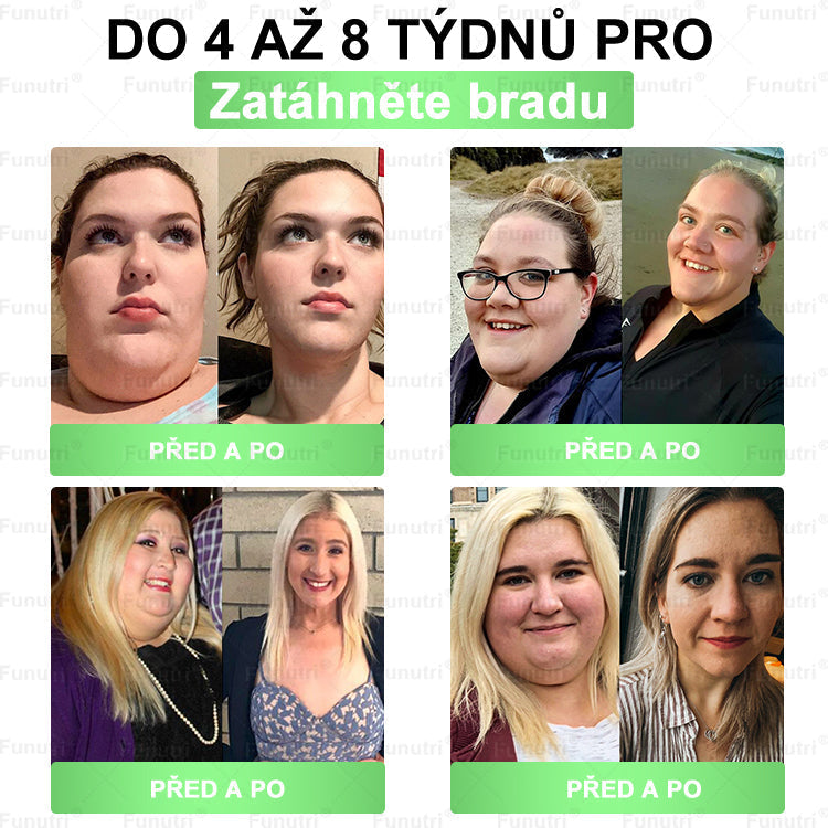 Oficiální obchod 💯 Funutri® 10 v 1 metabolická tvarující náplast s nano mikrojehličkami (Pouze jednou denně, viditelné změny již za 7 dní)  Určeno pro osoby s obezitou, diabetem, spánkovou apnoe