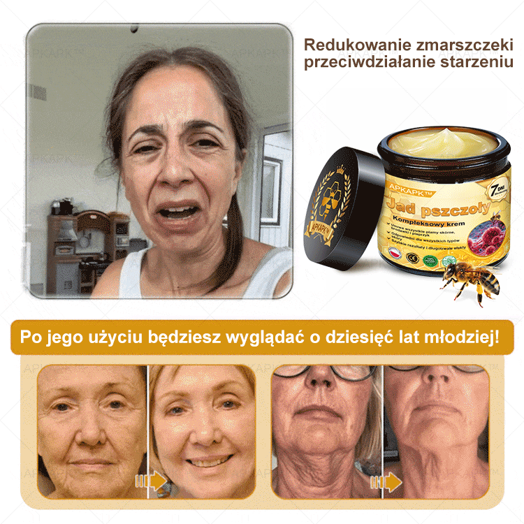 𝖠𝖯𝖪𝖠𝖯𝖪® 𝗕𝗲𝗲 𝗩𝗲𝗻𝗼𝗺 𝗞𝗿𝗲𝗺 𝗻𝗮 𝗼𝗯𝗻𝗼𝘄𝗲𝗻𝗶𝗲 𝗸𝗼𝘇𝗵𝘆🐝pomaga w leczeniu problemów skórnych, takich jak: zmarszczki, blizny, plamy pigmentacyjne, rozstępy, trądzik, łuszczyca, egzema, zmiany skórne, podrażnienia, stany zapalne i inne problemy skórne