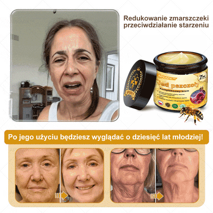 𝖠𝖯𝖪𝖠𝖯𝖪® 𝗕𝗲𝗲 𝗩𝗲𝗻𝗼𝗺 𝗞𝗿𝗲𝗺 𝗻𝗮 𝗼𝗯𝗻𝗼𝘄𝗲𝗻𝗶𝗲 𝗸𝗼𝘇𝗵𝘆🐝pomaga w leczeniu problemów skórnych, takich jak: zmarszczki, blizny, plamy pigmentacyjne, rozstępy, trądzik, łuszczyca, egzema, zmiany skórne, podrażnienia, stany zapalne i inne problemy skórne