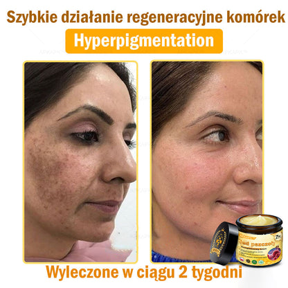 𝖠𝖯𝖪𝖠𝖯𝖪® 𝗕𝗲𝗲 𝗩𝗲𝗻𝗼𝗺 𝗞𝗿𝗲𝗺 𝗻𝗮 𝗼𝗯𝗻𝗼𝘄𝗲𝗻𝗶𝗲 𝗸𝗼𝘇𝗵𝘆🐝pomaga w leczeniu problemów skórnych, takich jak: zmarszczki, blizny, plamy pigmentacyjne, rozstępy, trądzik, łuszczyca, egzema, zmiany skórne, podrażnienia, stany zapalne i inne problemy skórne