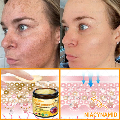 𝖠𝖯𝖪𝖠𝖯𝖪® 𝗕𝗲𝗲 𝗩𝗲𝗻𝗼𝗺 𝗞𝗿𝗲𝗺 𝗻𝗮 𝗼𝗯𝗻𝗼𝘄𝗲𝗻𝗶𝗲 𝗸𝗼𝘇𝗵𝘆🐝pomaga w leczeniu problemów skórnych, takich jak: zmarszczki, blizny, plamy pigmentacyjne, rozstępy, trądzik, łuszczyca, egzema, zmiany skórne, podrażnienia, stany zapalne i inne problemy skórne