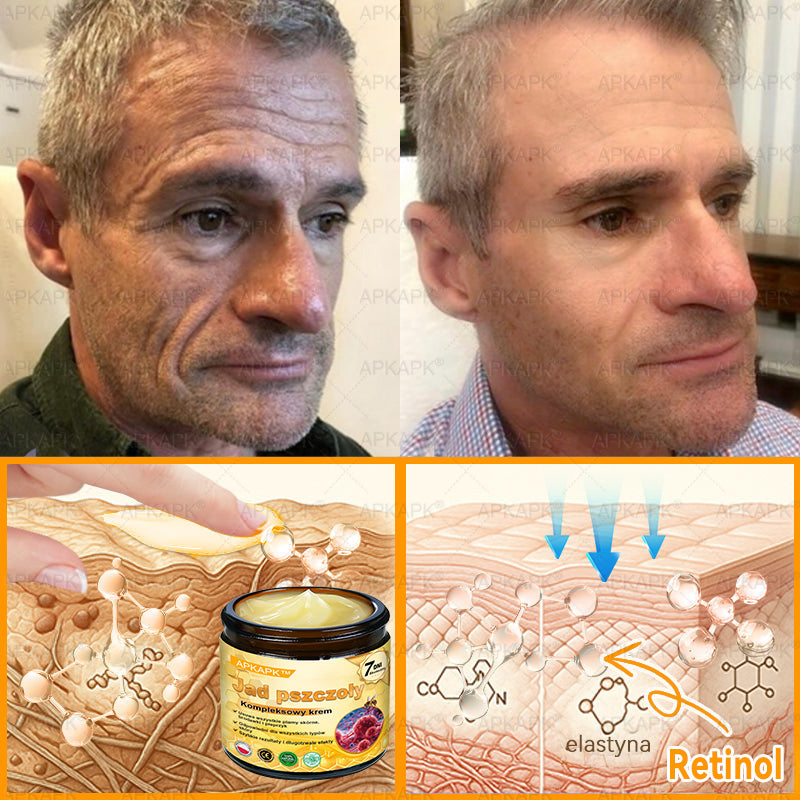 𝖠𝖯𝖪𝖠𝖯𝖪® 𝗕𝗲𝗲 𝗩𝗲𝗻𝗼𝗺 𝗞𝗿𝗲𝗺 𝗻𝗮 𝗼𝗯𝗻𝗼𝘄𝗲𝗻𝗶𝗲 𝗸𝗼𝘇𝗵𝘆🐝pomaga w leczeniu problemów skórnych, takich jak: zmarszczki, blizny, plamy pigmentacyjne, rozstępy, trądzik, łuszczyca, egzema, zmiany skórne, podrażnienia, stany zapalne i inne problemy skórne