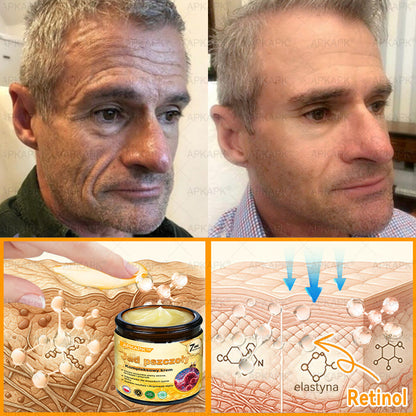 𝖠𝖯𝖪𝖠𝖯𝖪® 𝗕𝗲𝗲 𝗩𝗲𝗻𝗼𝗺 𝗞𝗿𝗲𝗺 𝗻𝗮 𝗼𝗯𝗻𝗼𝘄𝗲𝗻𝗶𝗲 𝗸𝗼𝘇𝗵𝘆🐝pomaga w leczeniu problemów skórnych, takich jak: zmarszczki, blizny, plamy pigmentacyjne, rozstępy, trądzik, łuszczyca, egzema, zmiany skórne, podrażnienia, stany zapalne i inne problemy skórne