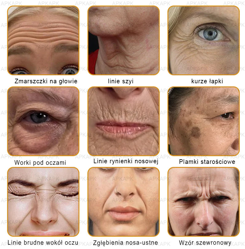 ΑPΚΑPK™ Jad Pszczoły Kompleksowy Krem🥇pomaga w leczeniu problemów skórnych, takich jak: zmarszczki, blizny, plamy pigmentacyjne, rozstępy, trądzik, łuszczyca, egzema, zmiany skórne, podrażnienia, stany zapalne i inne problemy skórne🔥